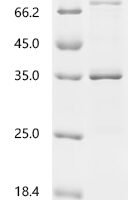 Saponaria officinalis Ribosome-inactivating protein saporin-9 (SAP9)(L8A) Recombinant Protein - BioCrest Sci