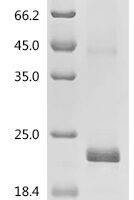Human Platelet-derived growth factor subunit B (PDGFB) Recombinant Protein, N-His - BioCrest Sci