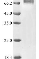 Human adenovirus C serotype 5 Hexon protein (L3) (T273A), partial Recombinant Protein - BioCrest Sci
