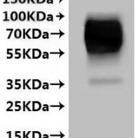 Human Hepatic sodium/bile acid cotransporter (SLC10A1)-VLPs Recombinant Protein - BioCrest Sci