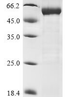 Human Leucine-rich repeat-containing G-protein coupled receptor 5 (LGR5), partial Recombinant Protein, N-His, aa 22–561, E.coli - BioCrest Sci
