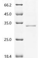 Mouse 1-acyl-sn-glycerol-3-phosphate acyltransferase beta (Agpat2)-Detergent Recombinant Protein - BioCrest Sci