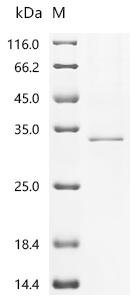 Mouse 1-acyl-sn-glycerol-3-phosphate acyltransferase beta (Agpat2)-Detergent Recombinant Protein, Mus musculus (Mouse), Mammalian cell, N-terminal 10xHis-tagged and C-terminal Twin-Strep-tagged, 32.8 kDa, purity >≥ 85% as determined by SDS-PAGE.