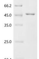 Pseudomonas aeruginosa LPS-assembly protein lptD (lptD), partial Recombinant Protein - BioCrest Sci