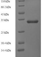 Apium graveolens Major allergen Api g 1, isoallergen 2 Recombinant Protein, N-His-SUMO - BioCrest Sci