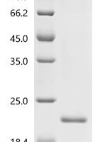 Human Interleukin-13 (IL13) Recombinant Protein, C-His, aa 25–146, E.coli - BioCrest Sci