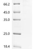 Human E3 ubiquitin-protein ligase COP1 (COP1) Recombinant Protein - BioCrest Sci