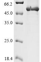 Cricetulus griseus Elongation factor 1-alpha 1 (EEF1A1) Recombinant Protein, N-His - BioCrest Sci