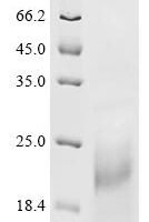 Mouse Cyclin-dependent kinase inhibitor 1 (Cdkn1a) Recombinant Protein - BioCrest Sci