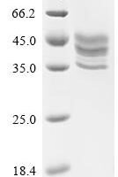 Human Tumor necrosis factor receptor superfamily member 13C (TNFRSF13C)(L27A,V29T,H31S), partial Recombinant Protein - BioCrest Sci