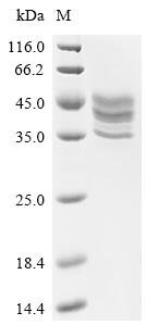 Human Tumor necrosis factor receptor superfamily member 13C (TNFRSF13C)(L27A,V29T,H31S), partial Recombinant Protein, Homo sapiens (Human), Mammalian cell, C-terminal hFc1-tagged, 36.0 kDa, purity >≥ 95% as determined by SDS-PAGE.