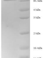 Human Inositol-trisphosphate 3-kinase B (ITPKB), partial Recombinant Protein - BioCrest Sci