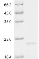 Aspergillus niger Endo-1,4-beta-xylanase 5 (XYN5) Recombinant Protein - BioCrest Sci