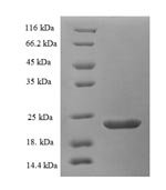 Echis carinatus Disintegrin EC3B Recombinant Protein, Echis carinatus (Saw-scaled viper), E.coli, N-terminal 6xHis-SUMO-tagged, 23.4 kDa, purity >≥ 90% as determined by SDS-PAGE.