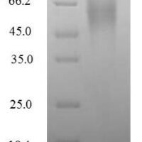 Rotavirus A Outer capsid glycoprotein VP7 Recombinant Protein, N-His - BioCrest Sci