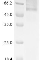 Human Glucosylceramidase (GBA) Recombinant Protein - BioCrest Sci