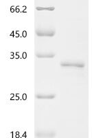 Human Transcriptional enhancer factor TEF-3 (TEAD4), partial Recombinant Protein, C-His - BioCrest Sci