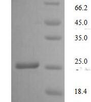 Human T-cell antigen CD7 (CD7), partial Recombinant Protein, N-His - BioCrest Sci