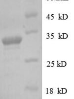 Human Protein delta homolog 1 (DLK1), partial Recombinant Protein, N-His, aa 24–303, E.coli - BioCrest Sci