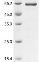 Human Hexokinase HKDC1 (HKDC1), partial Recombinant Protein - BioCrest Sci