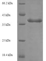Human Butyrophilin subfamily 3 member A3 (BTN3A3), partial Recombinant Protein, N-His-SUMO - BioCrest Sci