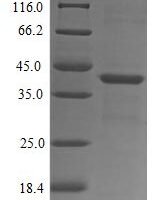 Human fMet-Leu-Phe receptor (FPR1), partial Recombinant Protein - BioCrest Sci