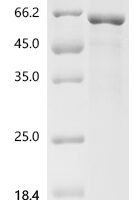 Human Elongator complex protein 3 (ELP3) Recombinant Protein, C-His, aa 1–547, E.coli - BioCrest Sci