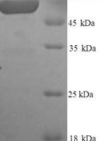 Rat Glypican-3 (Gpc3), partial Recombinant Protein - BioCrest Sci
