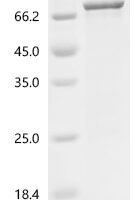 Human tRNA-dihydrouridine (47) synthase [NAD (P) (+)]-like (DUS3L) Recombinant Protein - BioCrest Sci