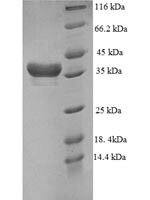 Human DTW domain-containing protein 1 (DTWD1), partial Recombinant Protein - BioCrest Sci