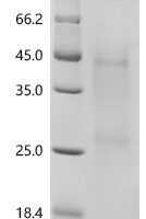 Human Ly6/PLAUR domain-containing protein 3 (LYPD3) Recombinant Protein - BioCrest Sci
