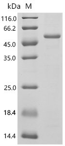 Human Adhesion G-protein coupled receptor G6 (ADGRG6), partial Recombinant Protein, C-His, Homo sapiens (Human), E.coli, C-terminal 6xHis-tagged, 50.9 kDa, purity >≥ 85% as determined by SDS-PAGE.