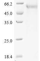 Mouse Pancreatic secretory granule membrane major glycoprotein GP2 (Gp2) Recombinant Protein, N-His - BioCrest Sci