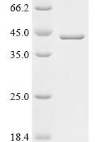 Human Serine/threonine-protein phosphatase 2A catalytic subunit alpha isoform (PPP2CA) Recombinant Protein, N-His - BioCrest Sci