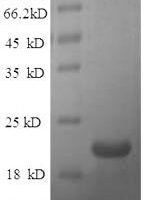 Rat Ephrin-A1 (Efna1) Recombinant Protein, N-His, aa 18–182, E.coli - BioCrest Sci