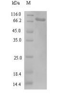 Human Kinesin light chain 3 (KLC3) Recombinant Protein, N-His-SUMO - BioCrest Sci