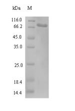 Human Kinesin light chain 3 (KLC3) Recombinant Protein, N-His-SUMO, Homo sapiens (Human), E.coli, N-terminal 6xHis-SUMO-tagged, 71.4 kDa, purity >≥ 90% as determined by SDS-PAGE.