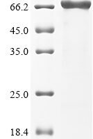Human Desmoglein-2 (DSG2), partial Recombinant Protein, N-10His - BioCrest Sci