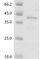 Human Paired box protein Pax-8 (PAX8), partial Recombinant Protein - BioCrest Sci
