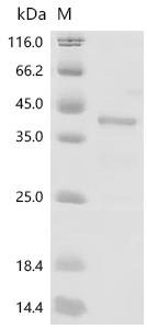 Human Paired box protein Pax-8 (PAX8), partial Recombinant Protein, Homo sapiens (Human), E.coli, C-terminal 6xHis-tagged, 37.3 kDa, purity >≥ 85% as determined by SDS-PAGE.