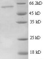 Mouse Thrombospondin-3 (Thbs3), partial Recombinant Protein, N-His - BioCrest Sci