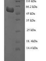 Escherichia coli Glutamate-pyruvate aminotransferase AlaA (alaA) Recombinant Protein - BioCrest Sci