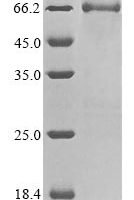Rat Electron transfer flavoprotein-ubiquinone oxidoreductase, mitochondrial (Etfdh) Recombinant Protein - BioCrest Sci