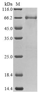 Rat Electron transfer flavoprotein-ubiquinone oxidoreductase, mitochondrial (Etfdh) Recombinant Protein, Rattus norvegicus (Rat), E.coli, N-terminal 6xHis-tagged, 68.6 kDa, purity >≥ 85% as determined by SDS-PAGE.