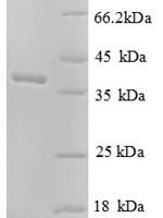 Human Soluble calcium-activated nucleotidase 1 (CANT1), partial Recombinant Protein, N-His - BioCrest Sci