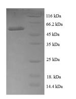 Escherichia coli Ribose-5-phosphate isomerase A (rpiA) Recombinant Protein, N-GST - BioCrest Sci