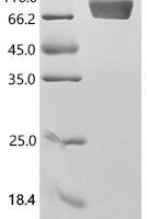 Human ICOS ligand (ICOSLG), partial Recombinant Protein - BioCrest Sci