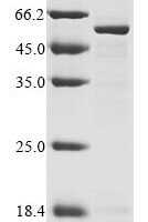 Mouse Ribitol-5-phosphate transferase FKTN (Fktn), partial Recombinant Protein - BioCrest Sci