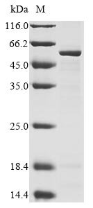 Mouse Ribitol-5-phosphate transferase FKTN (Fktn), partial Recombinant Protein, Mus musculus (Mouse), E.coli, N-terminal 10xHis-tagged and C-terminal Myc-tagged, 57.8 kDa, purity >≥ 85% as determined by SDS-PAGE.