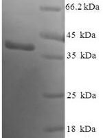 Human Sentrin-specific protease 8 (SENP8) Recombinant Protein - BioCrest Sci